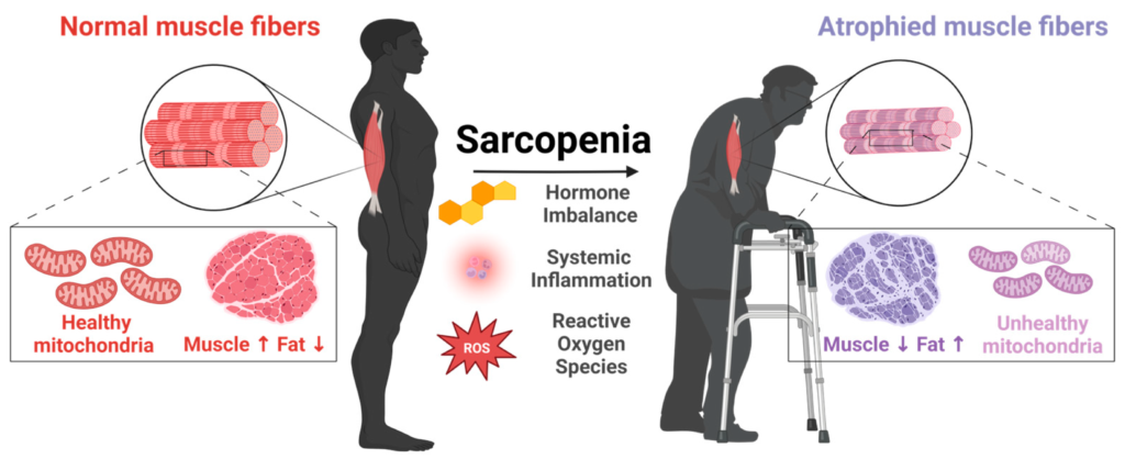 Why Sarcopenia is the Greatest Threat to Senior Independence (and How to Fight It)