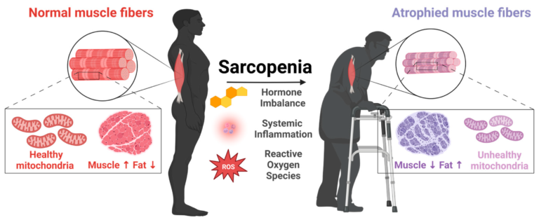 Why Sarcopenia is the Greatest Threat to Senior Independence (and How to Fight It)